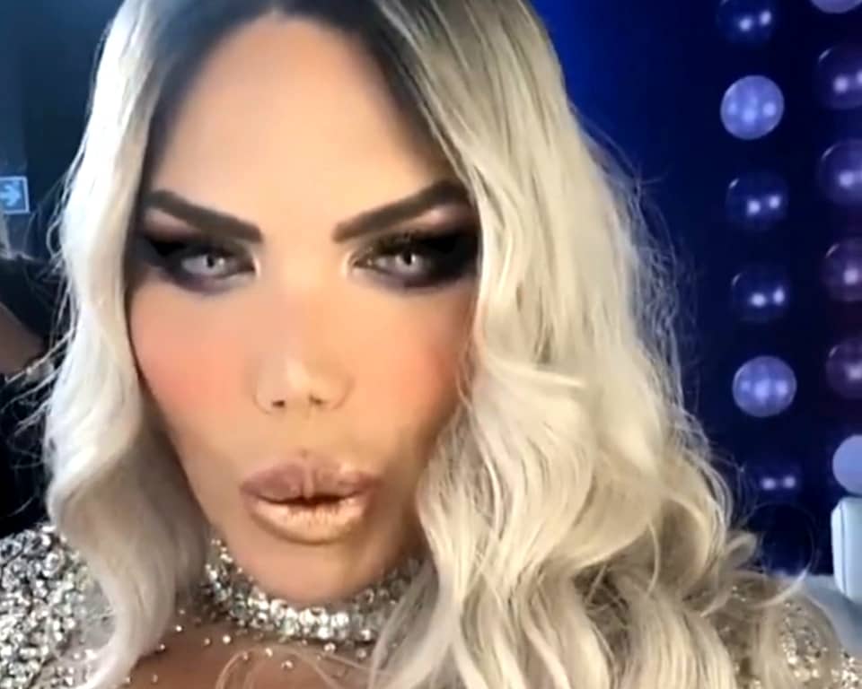 Rodrigo Alves è in Turchia per farsi il seno article-post