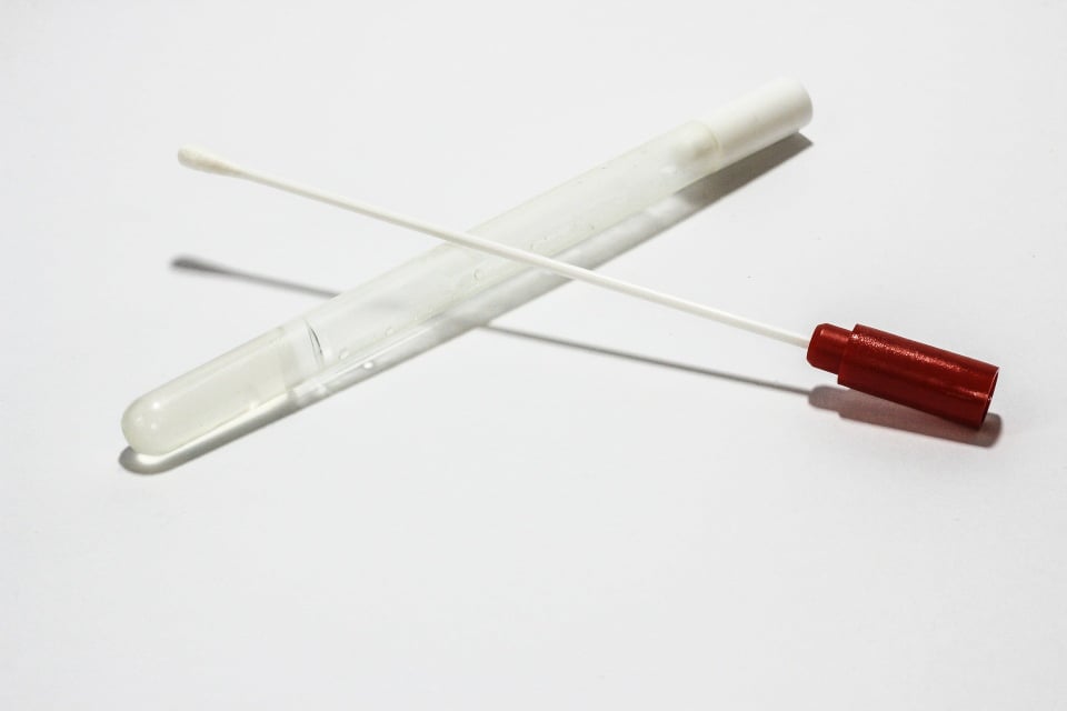 Tampone coronavirus: cos’è, come funziona e quanto costa article-post