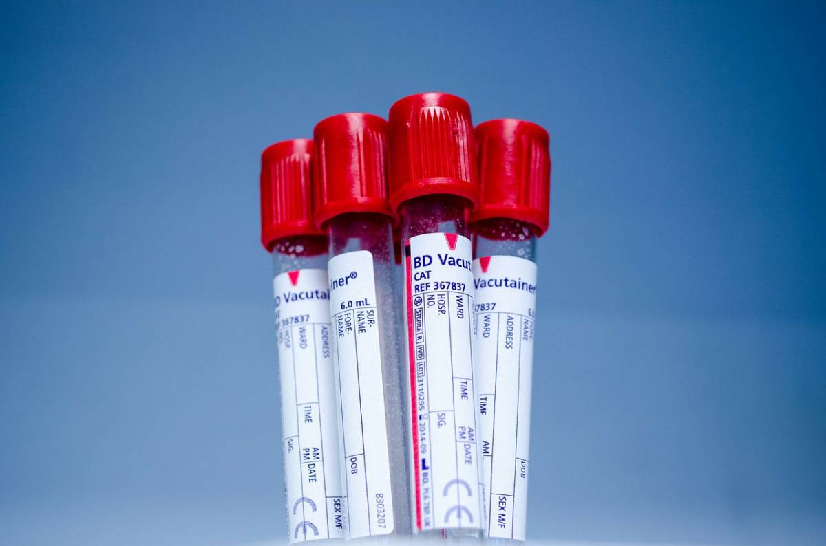 Calano le donazioni di sangue, l’appello dei medici article-post
