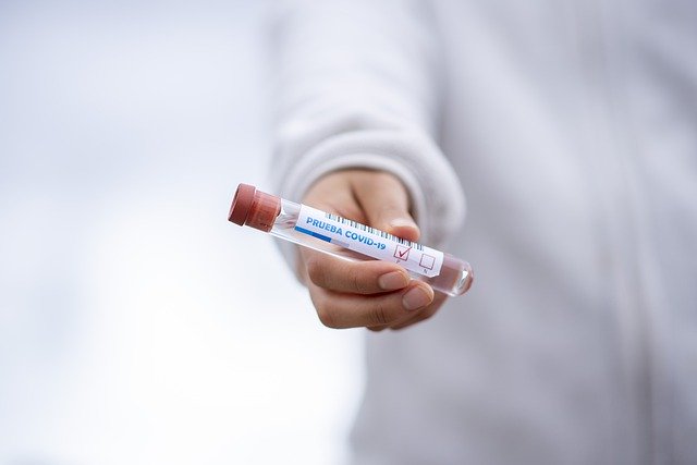 Croce Rossa, chiamata da 06-5510 è per test sierologici anti Covid-19 article-post
