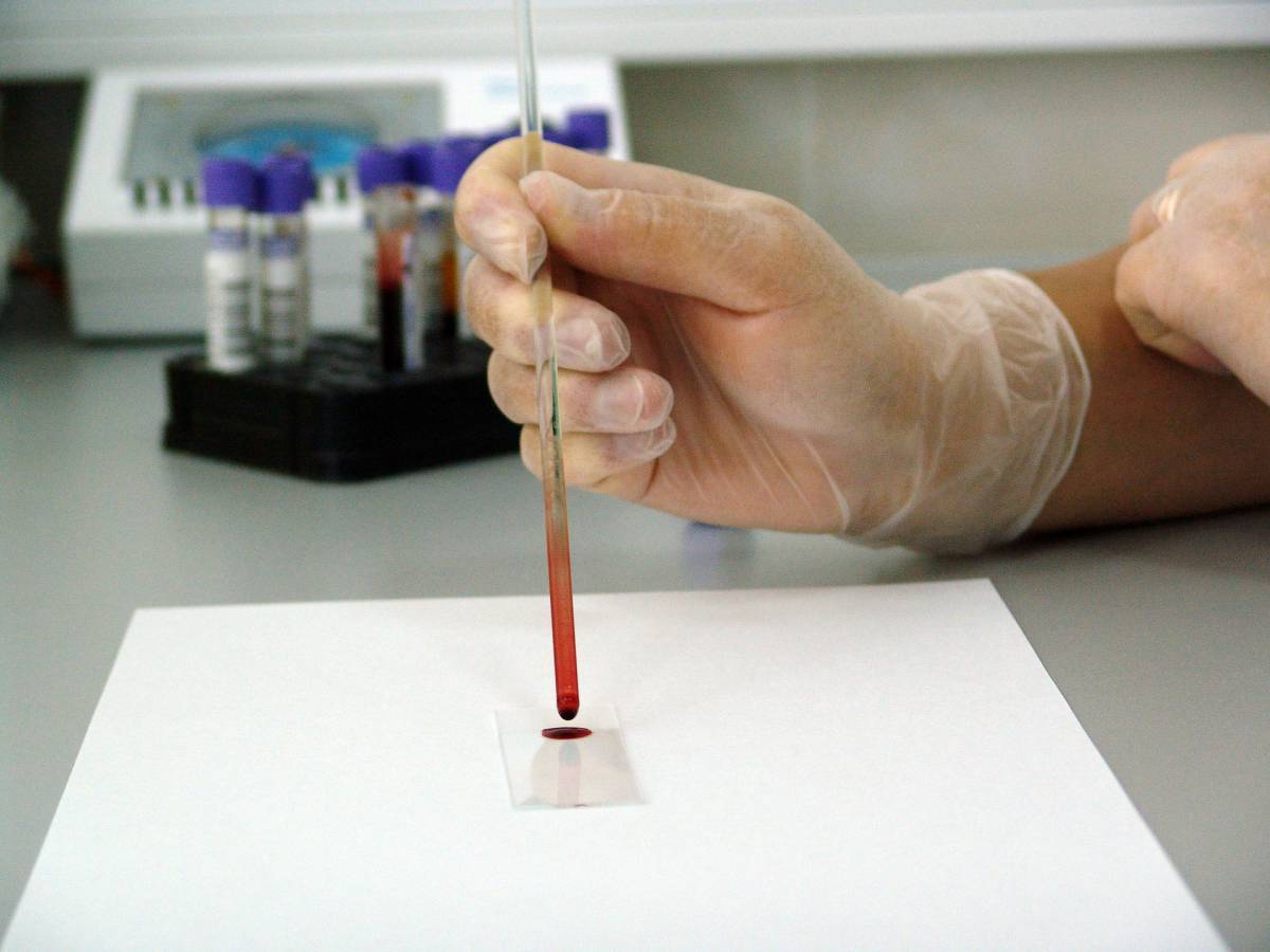 Esame del sangue riconosce cinque tipi di tumore in anticipo di 4 anni article-post