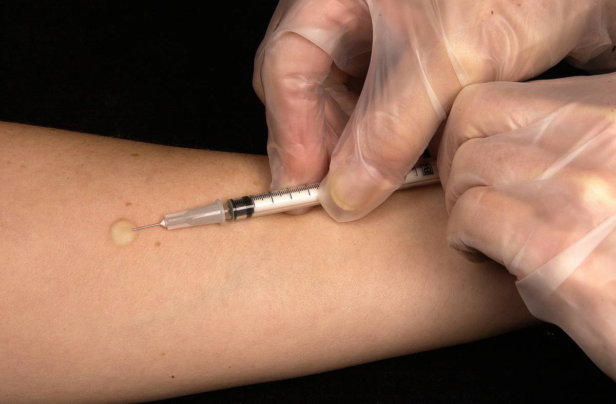 Vaccino anti-covid: oggi iniziano i test sull’uomo allo Spallanzani article-post
