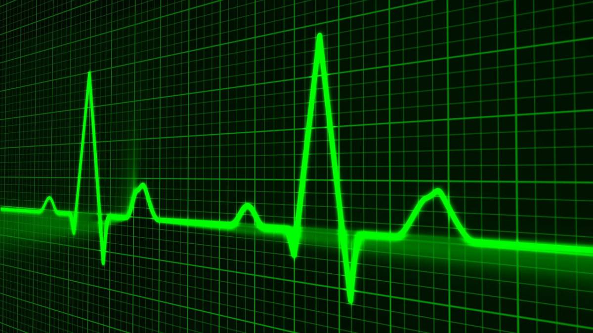 Il lockdown riduce le aritmie cardiache article-post