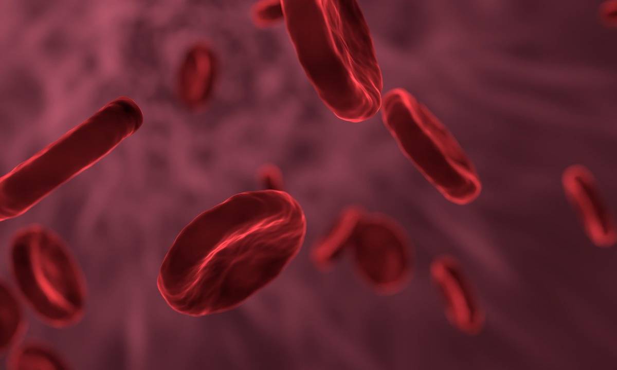 Dimostrata correlazione tra carenza di ferro e problemi cardiaci article-post