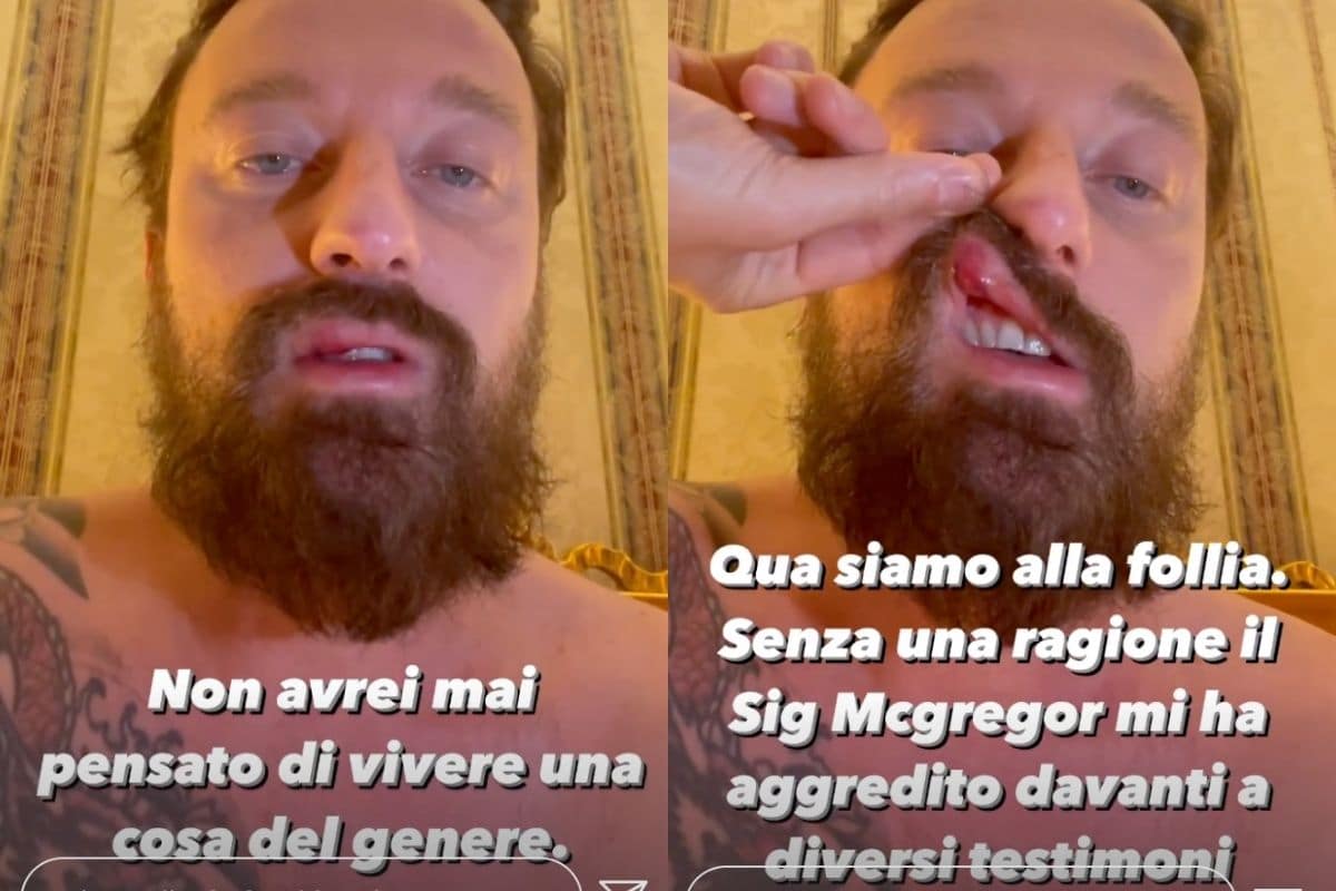 Francesco Facchinetti colpito da McGregor: il commento d’Alessia Marcuzzi article-post