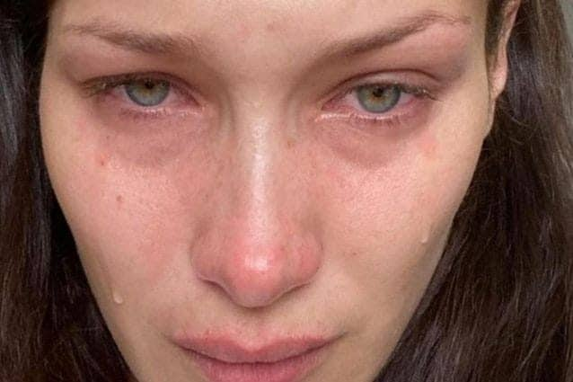 Depressione la denuncia di Bella Hadid: “Sui social non sono davvero io” article-post