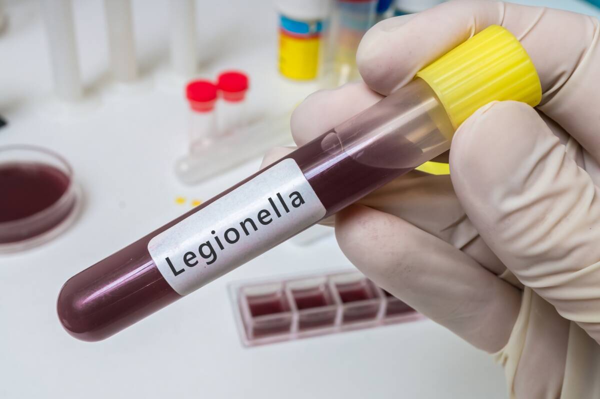 Legionella, morto un uomo a Milano article-post