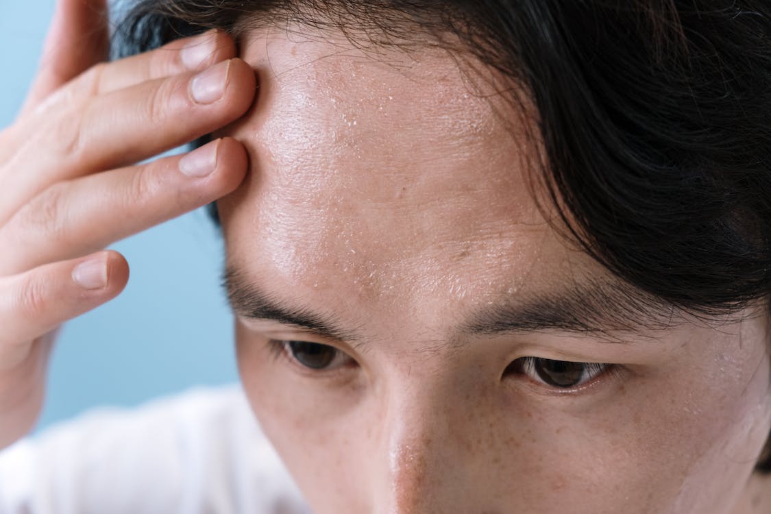 Dermatite atopica: che cos’è e quali sintomi comporta article-post