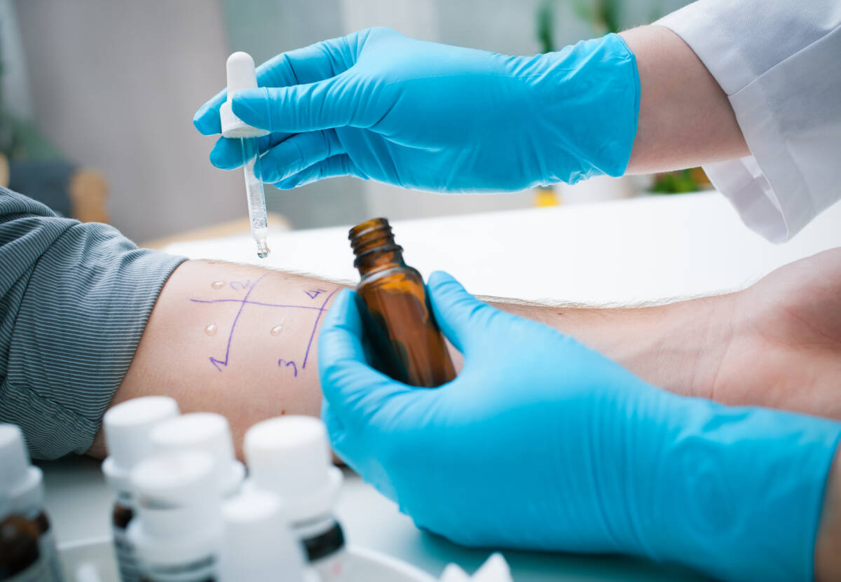 Test del sangue per allergie: diagnosi più mirate ma vengono utilizzati pochissimo in Italia article-post