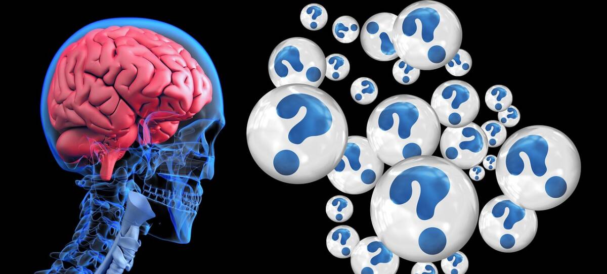 Un’area cerebrale svela segreti sulle scelte economiche: lo studio dei neuroscienziati del Sainsbury Wellcome Centre article-post
