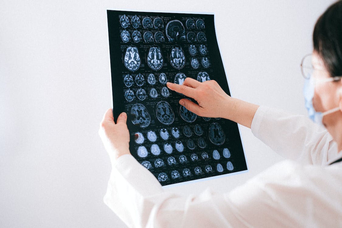 Tutto il cervello umano in un atlante: studio rivoluzionario su neuroni e cellule celebrali article-post