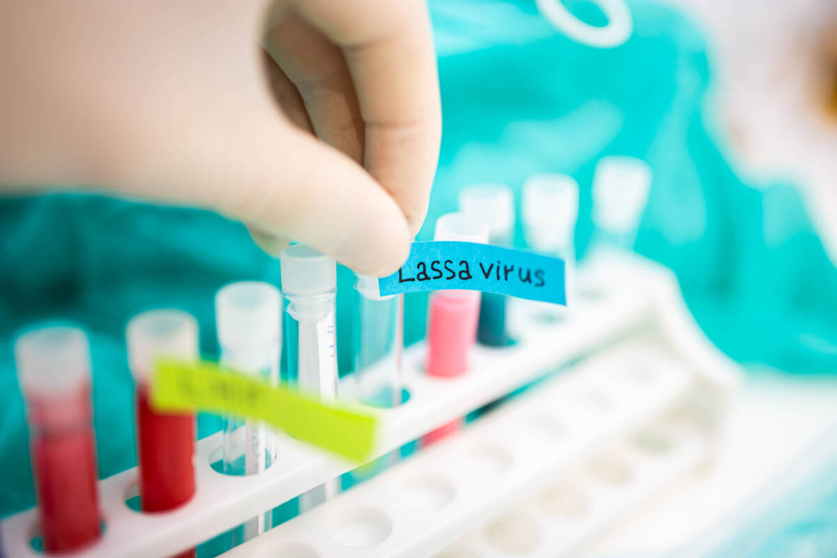 Febbre di Lassa, nuovo rischio pandemico? article-post