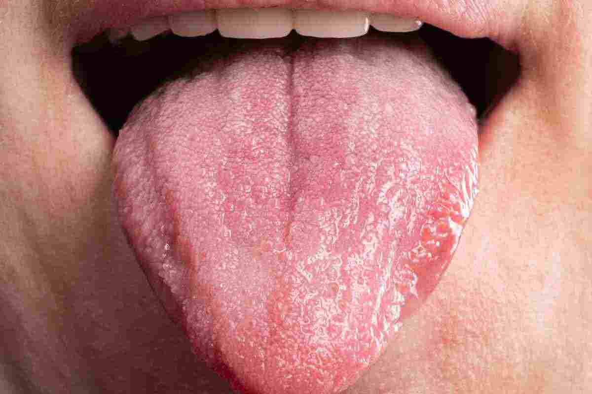 Come leggere la lingua per capire lo stato di salute del corpo article-post