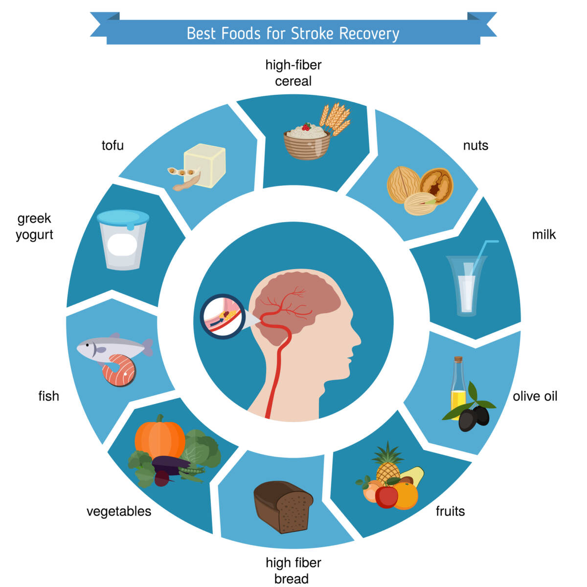 I 10 migliori cibi per l’intestino-cervello article-post