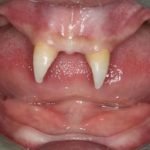 I denti più strani del mondo