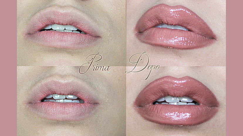 Come avere labbra più carnose alla Kylie Jenner preview