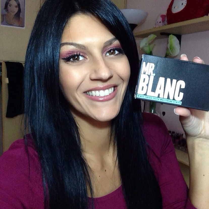 SBIANCAMENTO DENTI facile e veloce preview