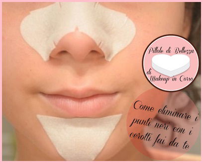 Punti neri: come eliminarli con i cerotti fai da te | WEGIRLS preview