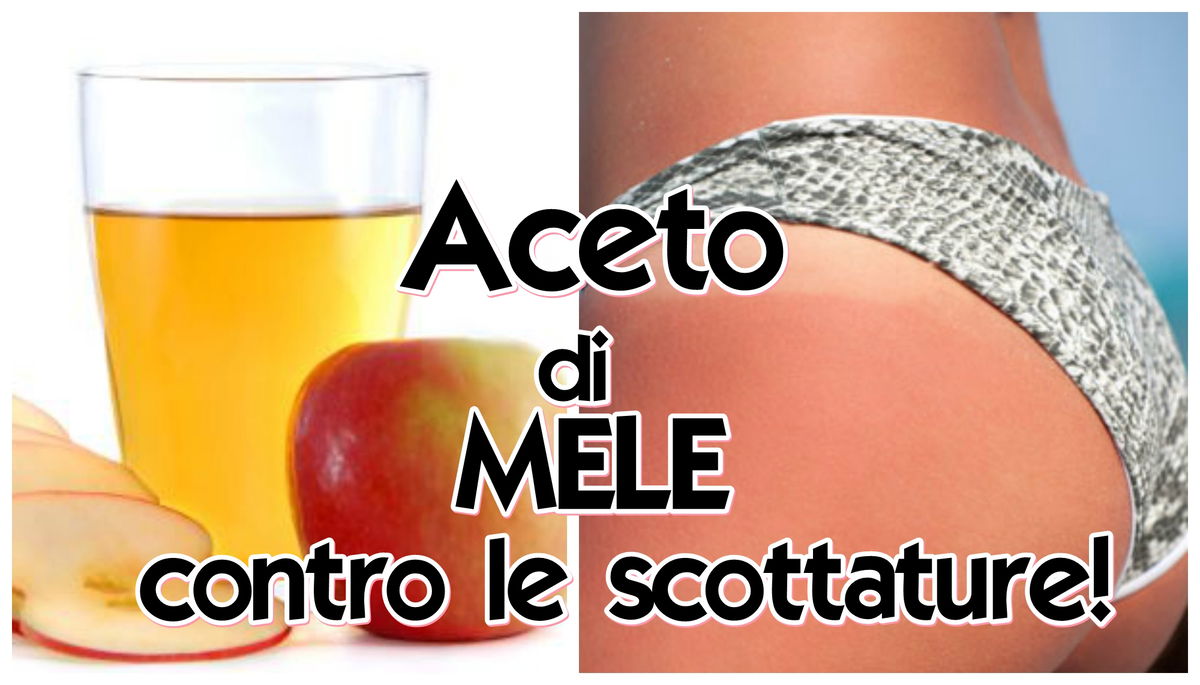 Aceto di mele contro le Scottature article-post