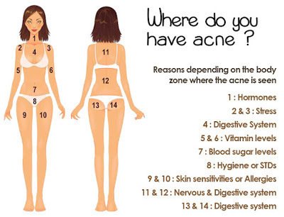 acne-1