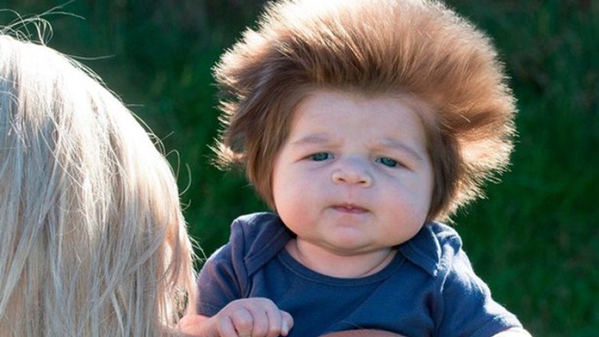 Il bambino con i capelli più folti del mondo - FOTOGALLERY ...